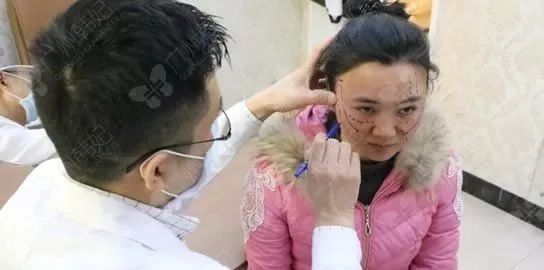 廣州韓妃美版超聲提拉和埋線提升提升日記一則，給你好看~