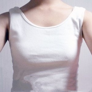 廣元美華楊林醫(yī)生做的自體脂肪隆胸，兩個(gè)月的果圖片分享~