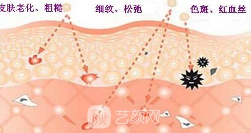 e光嫩膚