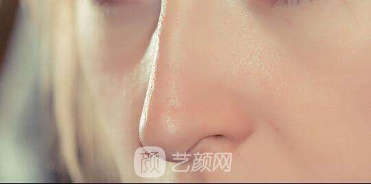 北京做修復鼻子需要多少錢？