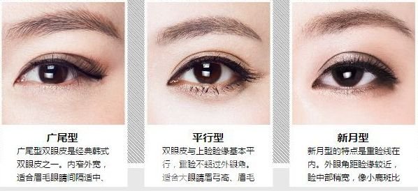 　蘇州內(nèi)雙割雙眼皮多少錢(qián)