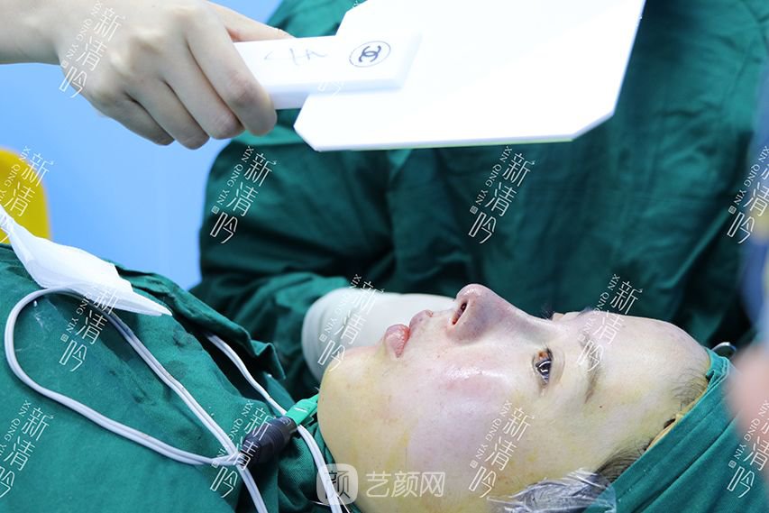 耳軟骨隆鼻果圖分享，術(shù)后~