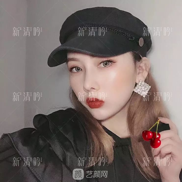 耳軟骨隆鼻果怎么樣？案例照片一覽~