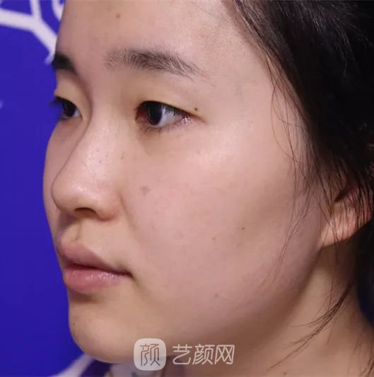出道三年，她整成這樣終于亮相芒果臺(tái)啦！