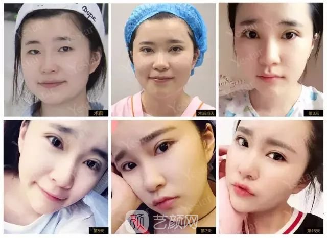 出道三年，她整成這樣終于亮相芒果臺(tái)啦！