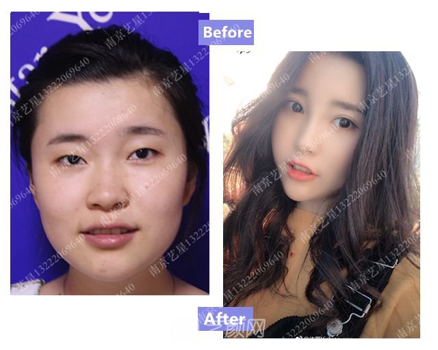 出道三年，她整成這樣終于亮相芒果臺(tái)啦！