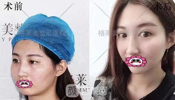 福州格萊美跨年造美節(jié)開始啦，四重好禮送不停，5人同行項目5折起~