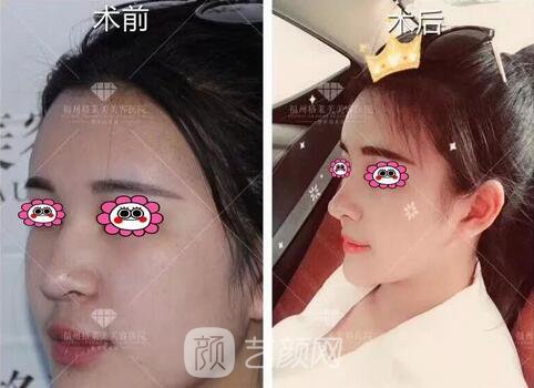 福州格萊美跨年造美節(jié)開始啦，四重好禮送不停，5人同行項目5折起~