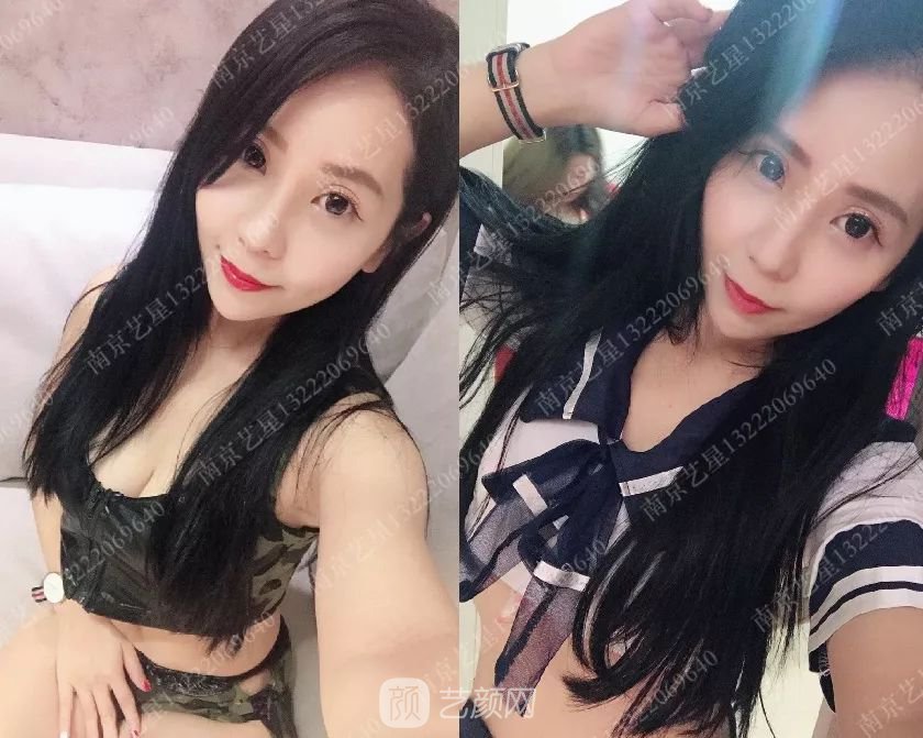 只需要5分鐘，我的鼻子變高了！——南京藝星玻尿酸隆鼻~