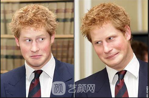 徐崢回應脫發(fā)、英國小刺猬因壓力大脫毛！不得不說“禿”真是不分界的...