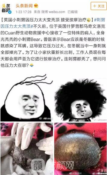 徐崢回應脫發(fā)、英國小刺猬因壓力大脫毛！不得不說“禿”真是不分界的...