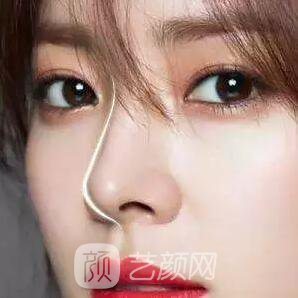 俗話說：三分整形，七分養(yǎng)護!關(guān)于術(shù)后養(yǎng)護，你做到幾分