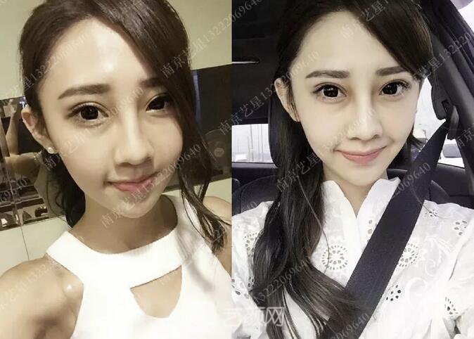 眼霜不管用，拿什么拯救你我的淚溝~