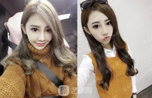 眼霜不管用，拿什么拯救你我的淚溝~