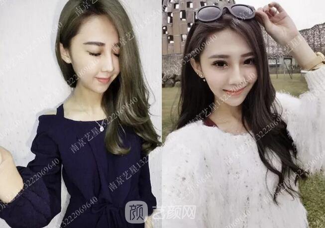 眼霜不管用，拿什么拯救你我的淚溝~