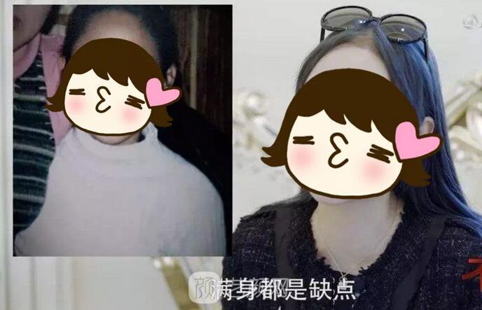 【竟因一件衣服決定整容！她的現(xiàn)狀如何？】