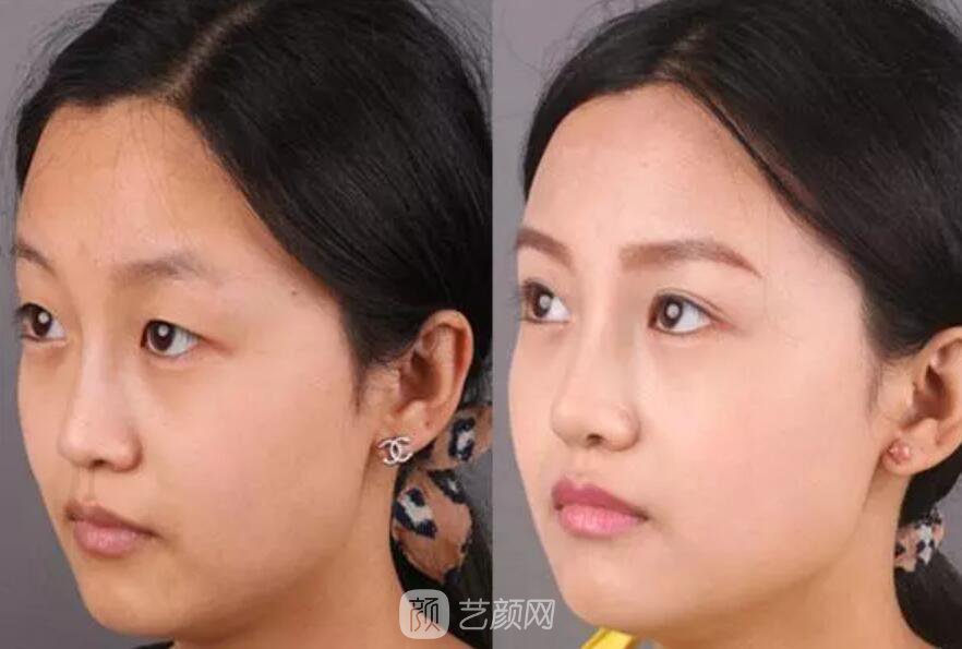 曾經(jīng)被我嘲笑的小眼睛室友，如今變得艷壓群芳？！