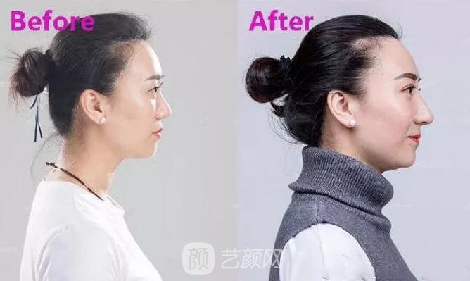 曾經(jīng)被我嘲笑的小眼睛室友，如今變得艷壓群芳？！