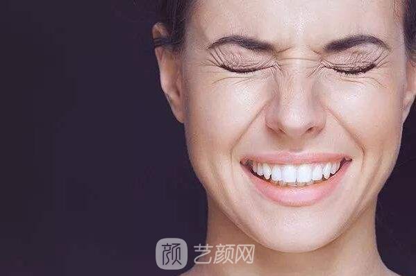 魚尾紋怎么去?不用糾結(jié)來(lái)深圳藝星