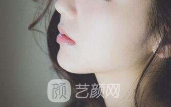 重慶銅雀臺(tái)打玻尿酸墊下巴果