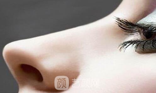 玻尿酸隆鼻后變成氣質女神