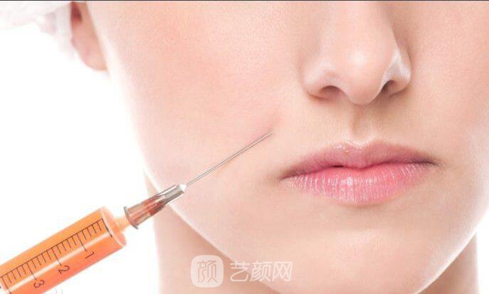 上海南山醫(yī)院塑形專家季錦付：關(guān)于吸脂瘦臉的注意事項(xiàng)