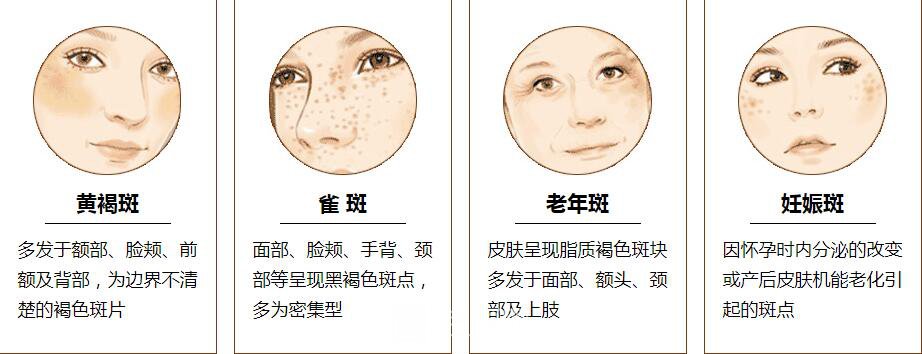 調(diào)節(jié)黃褐斑是長期的工程，需要堅(jiān)持才能見果