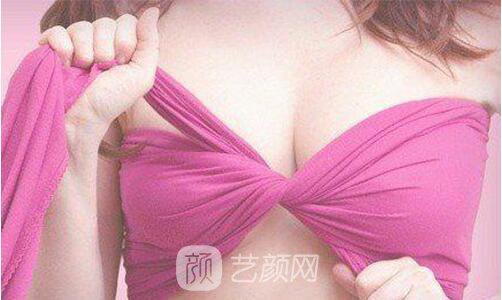 自體脂肪隆胸常見(jiàn)十大問(wèn)題 科學(xué)解開(kāi)隆胸的顧慮