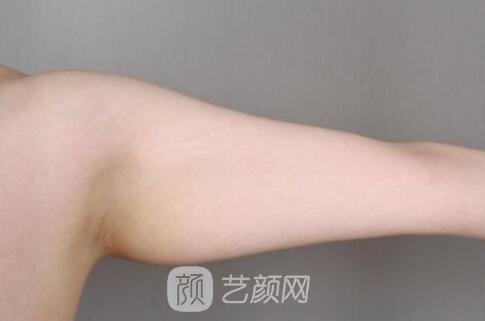 全新項目吸脂所讓顧客困擾的問題有哪些?