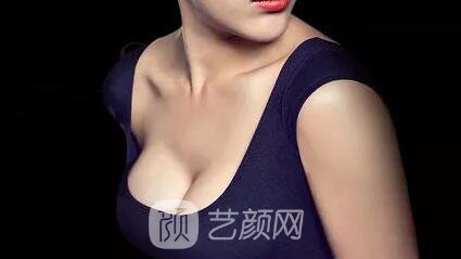 娜高乳房假體隆胸一個(gè)月后 挺胸走路找回了自信