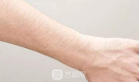 深圳翠綠寶石激光脫毛如何？我們一起來了解一下