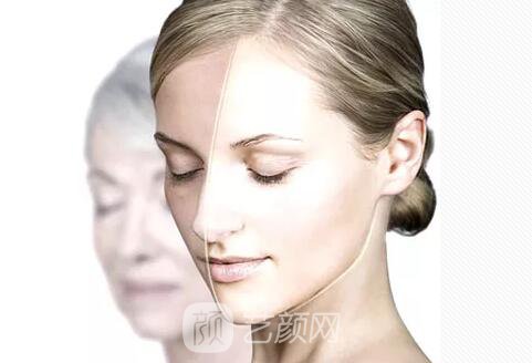 熱拉提緊膚又除皺