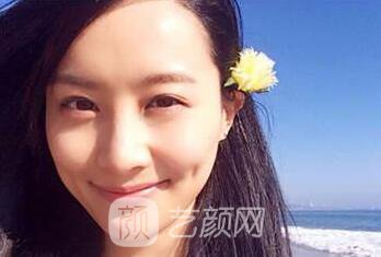 如果是你去做隆鼻 你想要網(wǎng)紅鼻還是個性鼻?