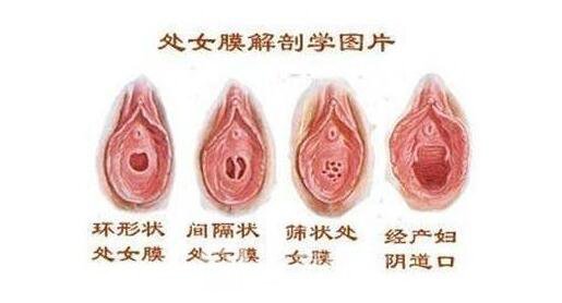 阜新修復處女膜哪好?