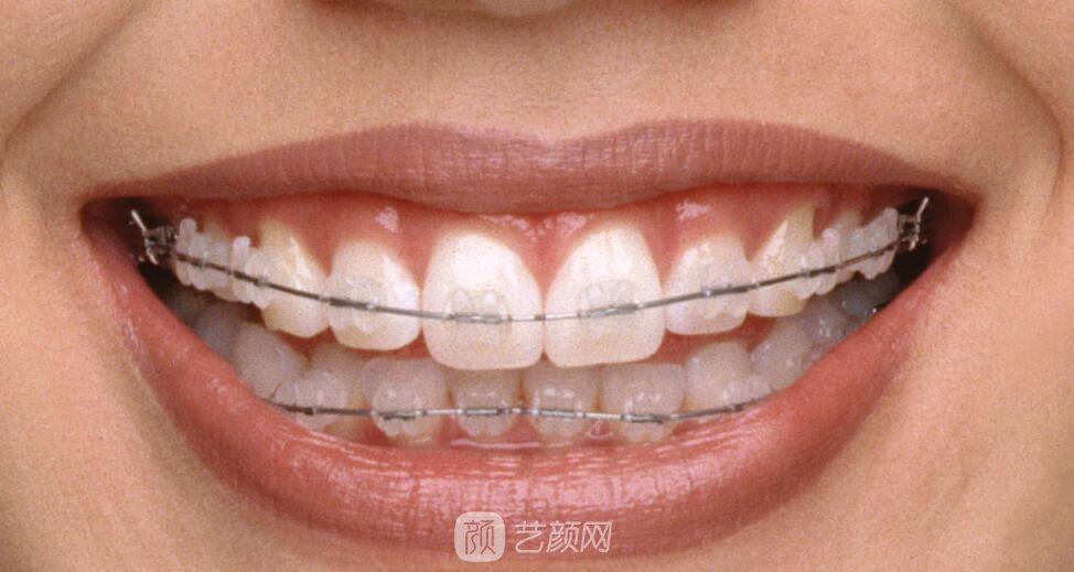 衡陽市牙齒整形選哪家醫(yī)院好