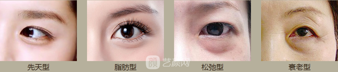 洛陽做眼袋哪里好，費用如何