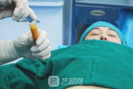 廉紅偉在水動(dòng)力吸脂方面有著嫻熟的手法，他的方法對(duì)身體傷害極小