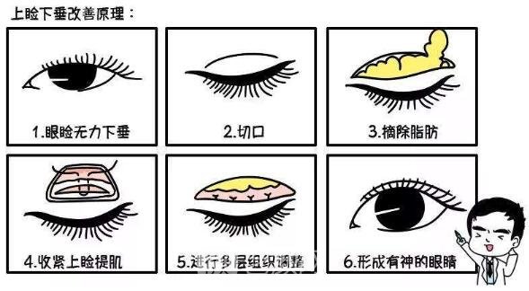  【眼部手術(shù)手術(shù)】九院眼部手術(shù)手術(shù)哪位醫(yī)生做的好？