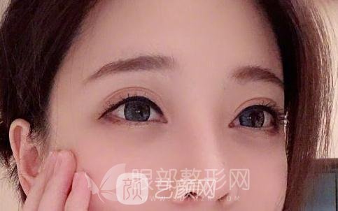 斗魚第一女主播馮提莫的進化史：從素人到網(wǎng)紅！
